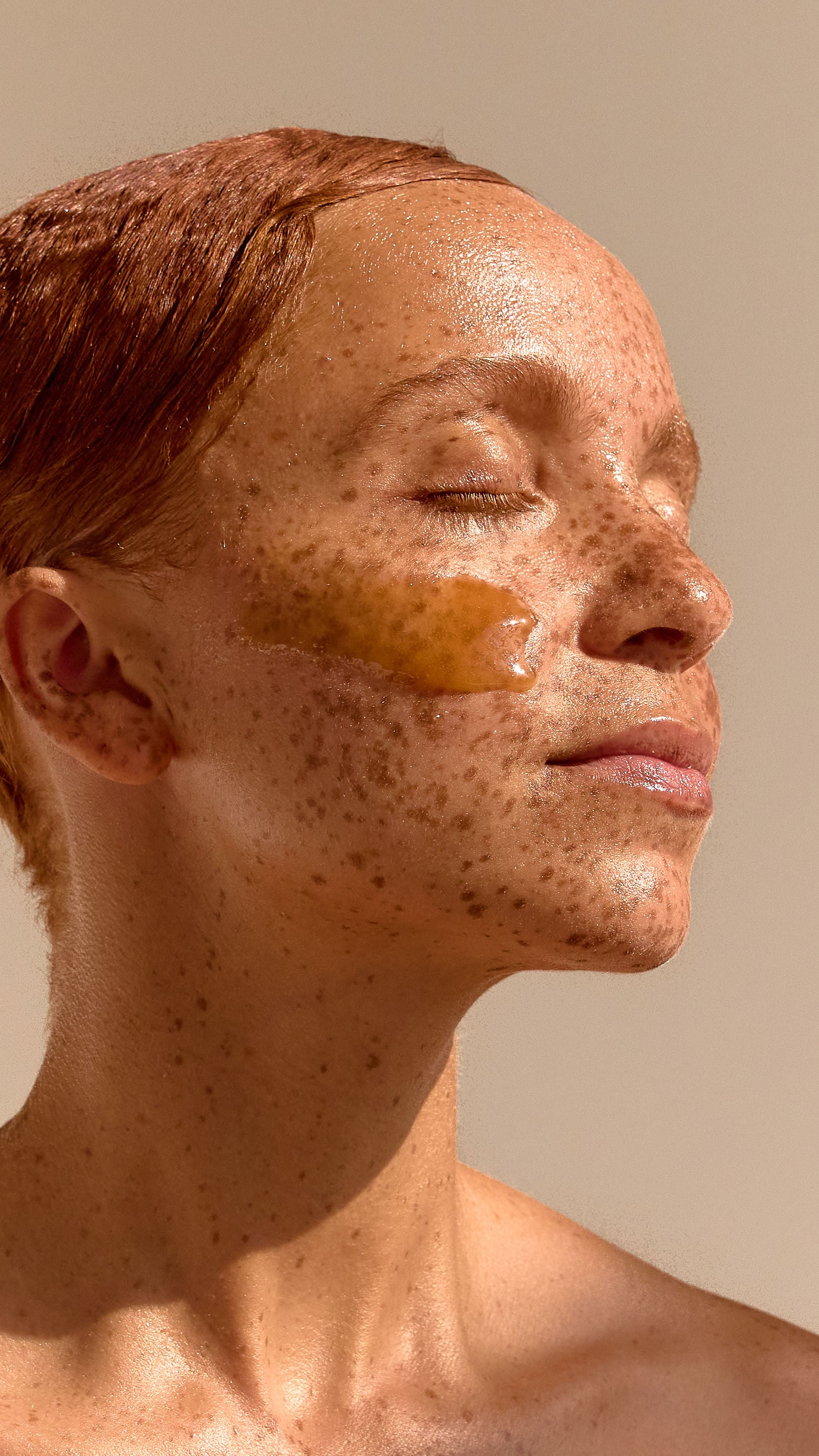 The Acne Kit